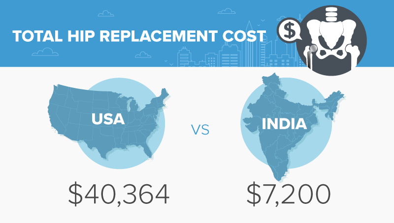 Hip replacement costs.
