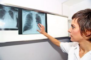 woman looking at lung