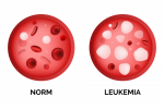 leukemia comparison