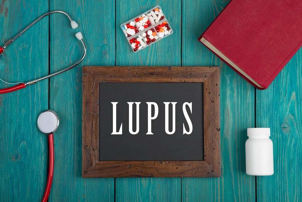 Acupuncture & Alternative Treatments for Lupus